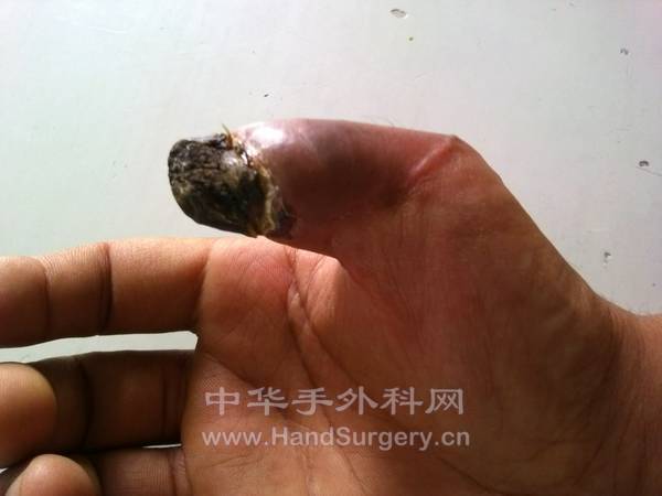 我的相册