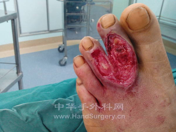 我的相册