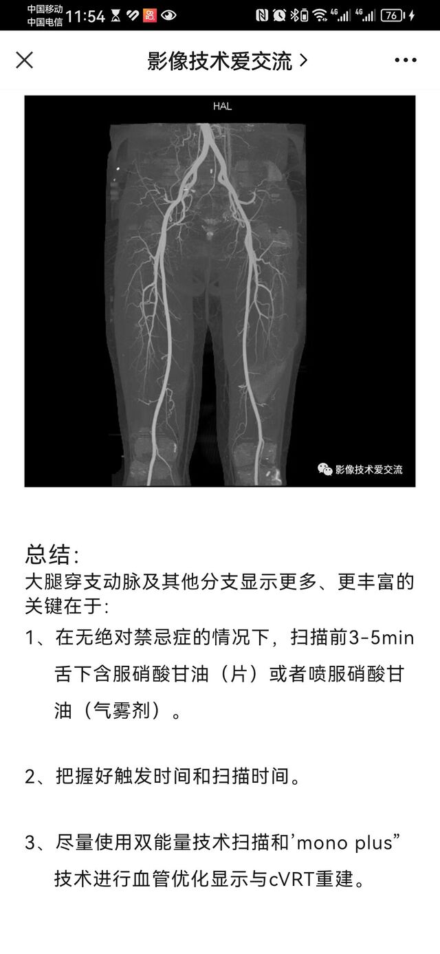 Screenshot_20231025_235430_com.tencent.mm.jpg