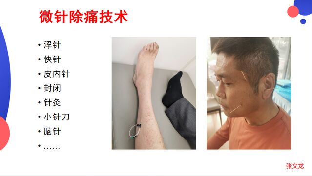 mmexport1775024630034.png